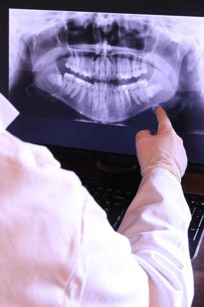 Best Emergency Wisdom Tooth Extraction in Carlton, OR